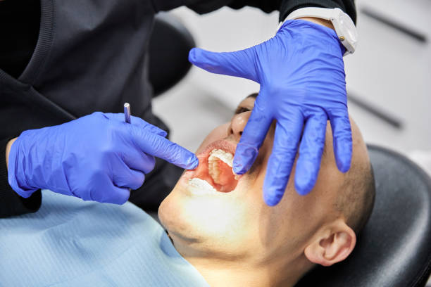 Best Emergency Treatment for Dental Infections or Abscesses in Homer, AK